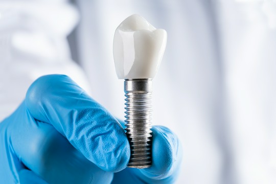 implant zęba